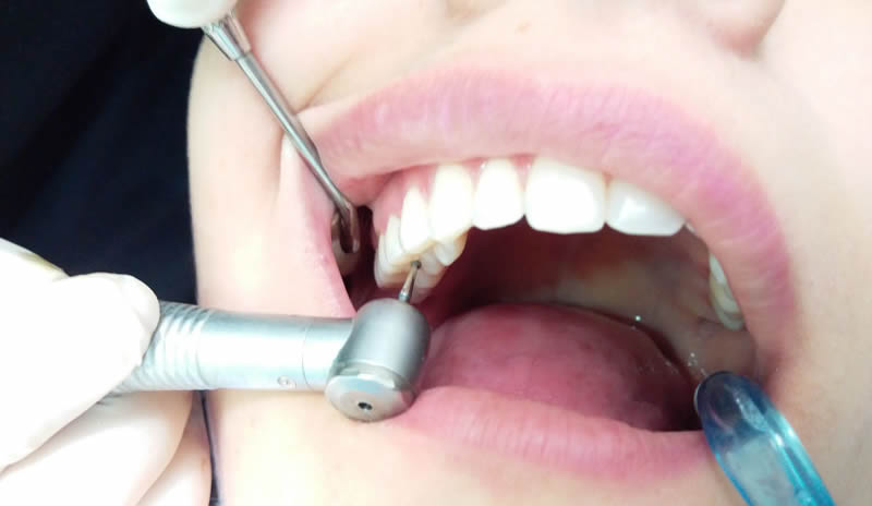Operatoria Dental